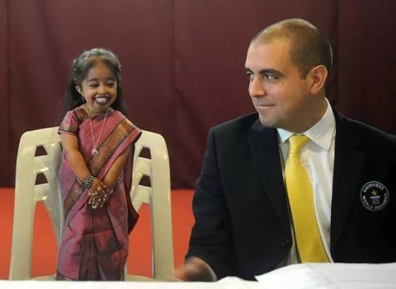 World's Smallest Woman